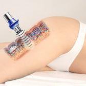 Cavitation 40kHz Online Training